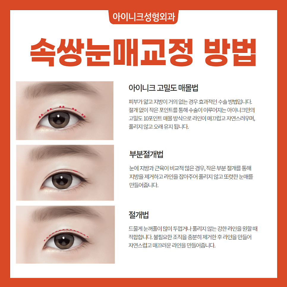 남자쌍수가격 보다 더 중요한 이것 관련 이미지 4