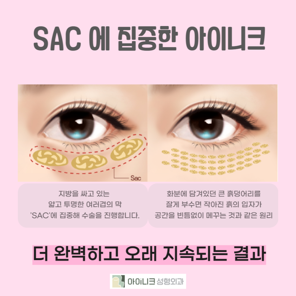 A Brighter Face Again with Under-Eye Surgery image 3