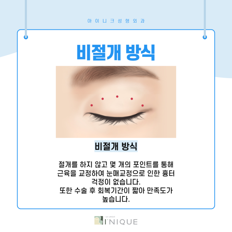 눈매과교정, 부작용을 예방하려면? 관련 이미지 4