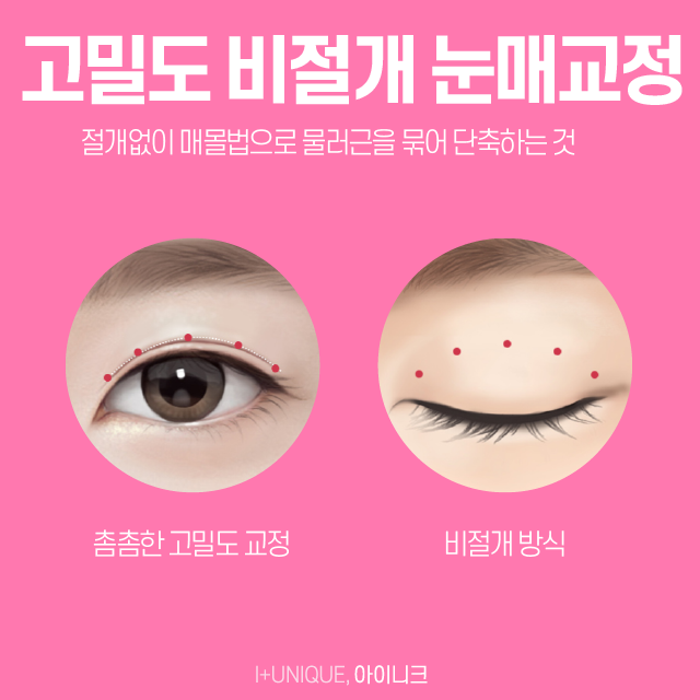 안검하수병원, 아무데나 갈수는 없죠 관련 이미지 4