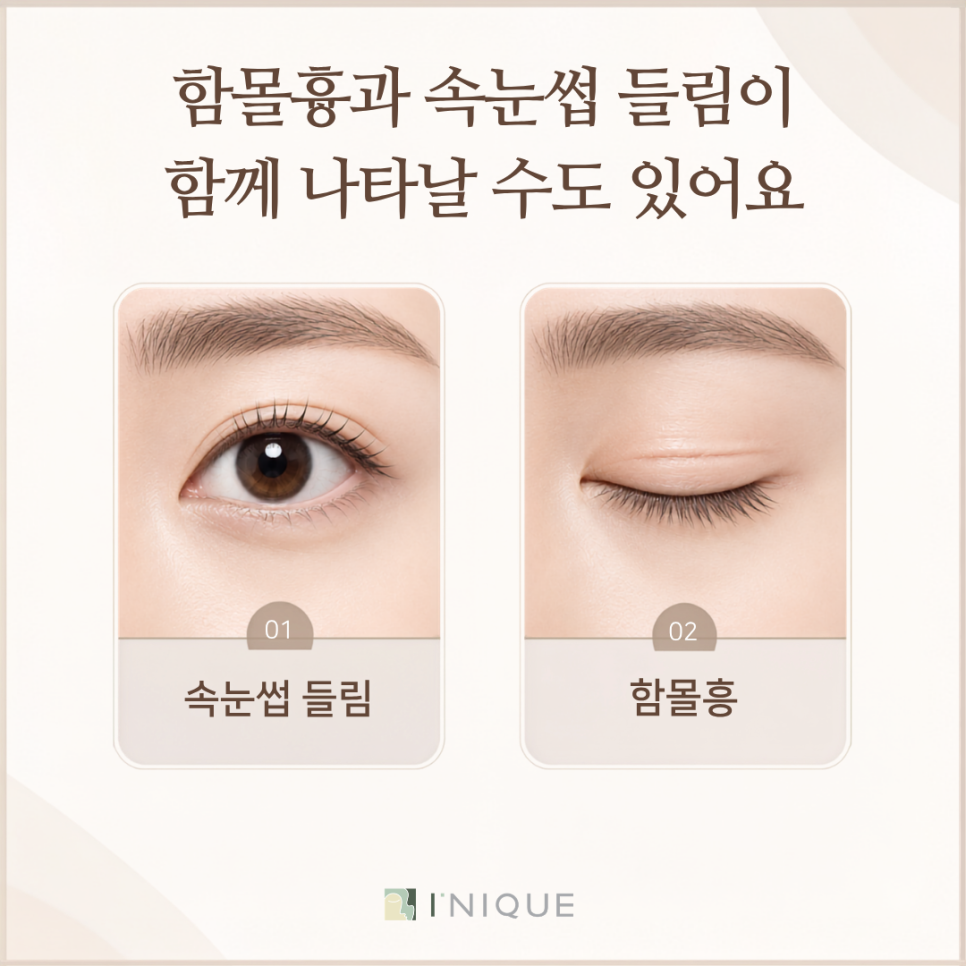 쌍수 절개 흉터, 깊게 남았다면 재수술을 해야 하나? 관련 이미지 3