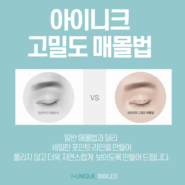 서울쌍커풀수술을 알아보고 있다면 아이니크 성형외과로 관련 이미지 4