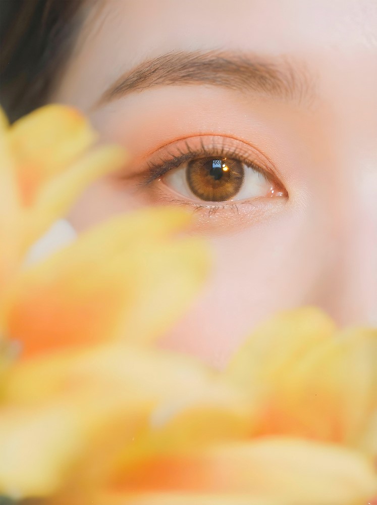 눈밑 꺼짐 시술 필러로 개선하는 방법 관련 이미지 13