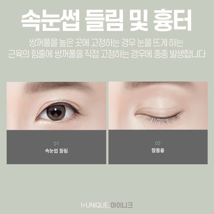 눈재성형을 고민하고 있다면, 믿을 수 있는 아이니크성형외과에서 관련 이미지 3