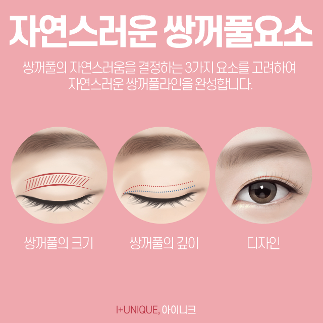 강남쌍커풀수술을 생각하고 있다면 신중하게 결정해야 하는 이유 관련 이미지 3