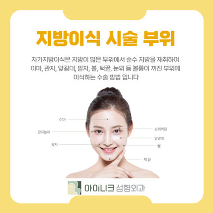 Apgujeong Fat Grafting: Youthful Facial Contouring with Your Own Fat image 4