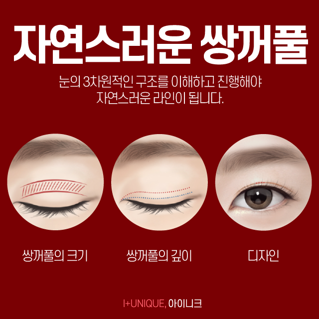 쌍꺼풀잘하는곳 여기로 결정하자! 관련 이미지 2