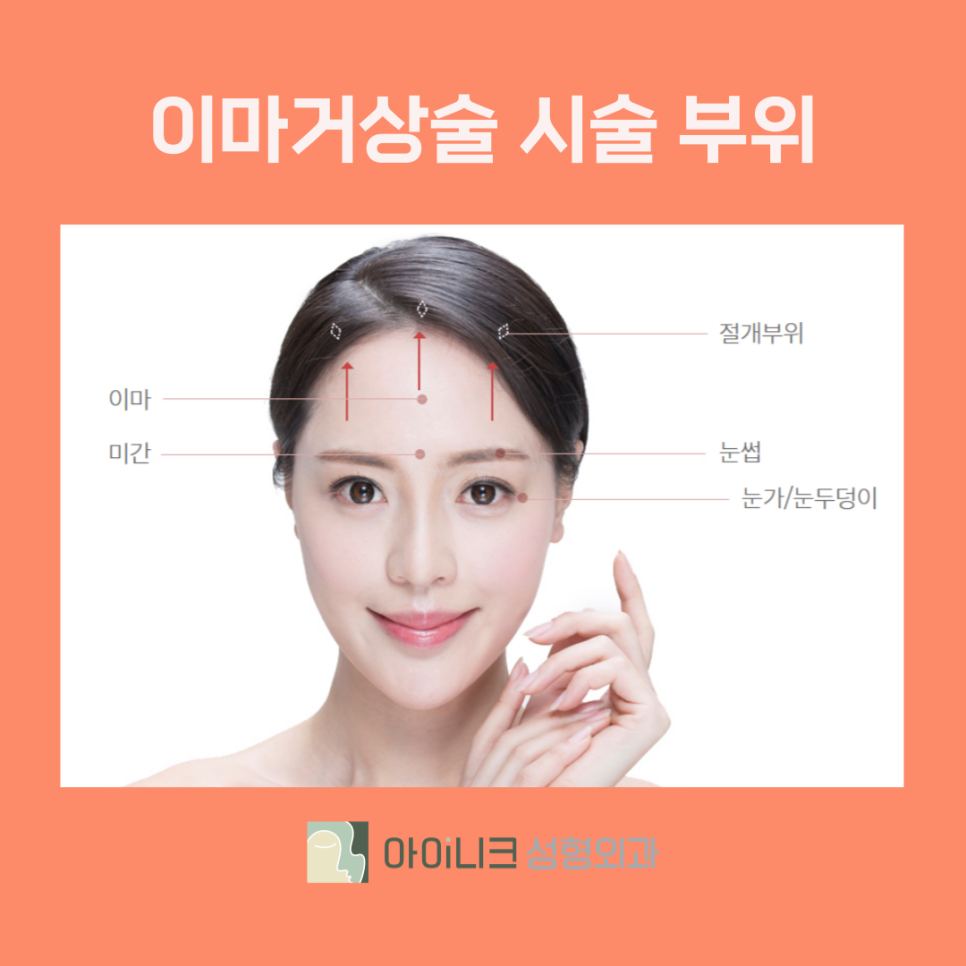 강남 이마거상 리프팅 노안 고민 해결하자 관련 이미지 5