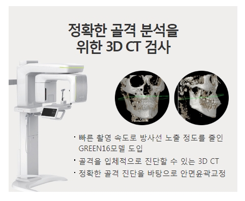 남자양악수술가격 비율에 맞는 자연스러운 라인! 관련 이미지 6