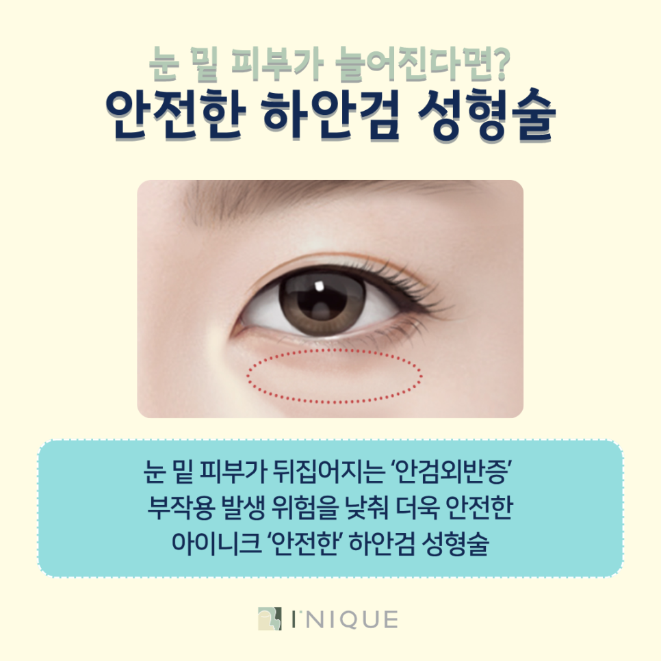 Mature Eye Reoperation Plastic Surgery: High Satisfaction from the First Surgery image 6