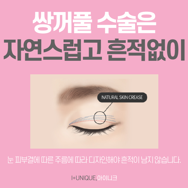 Introduction to Inique’s Double Eyelid Incision Method and Buried Suture Method for Test Takers! Discount Event in Progress! image 2