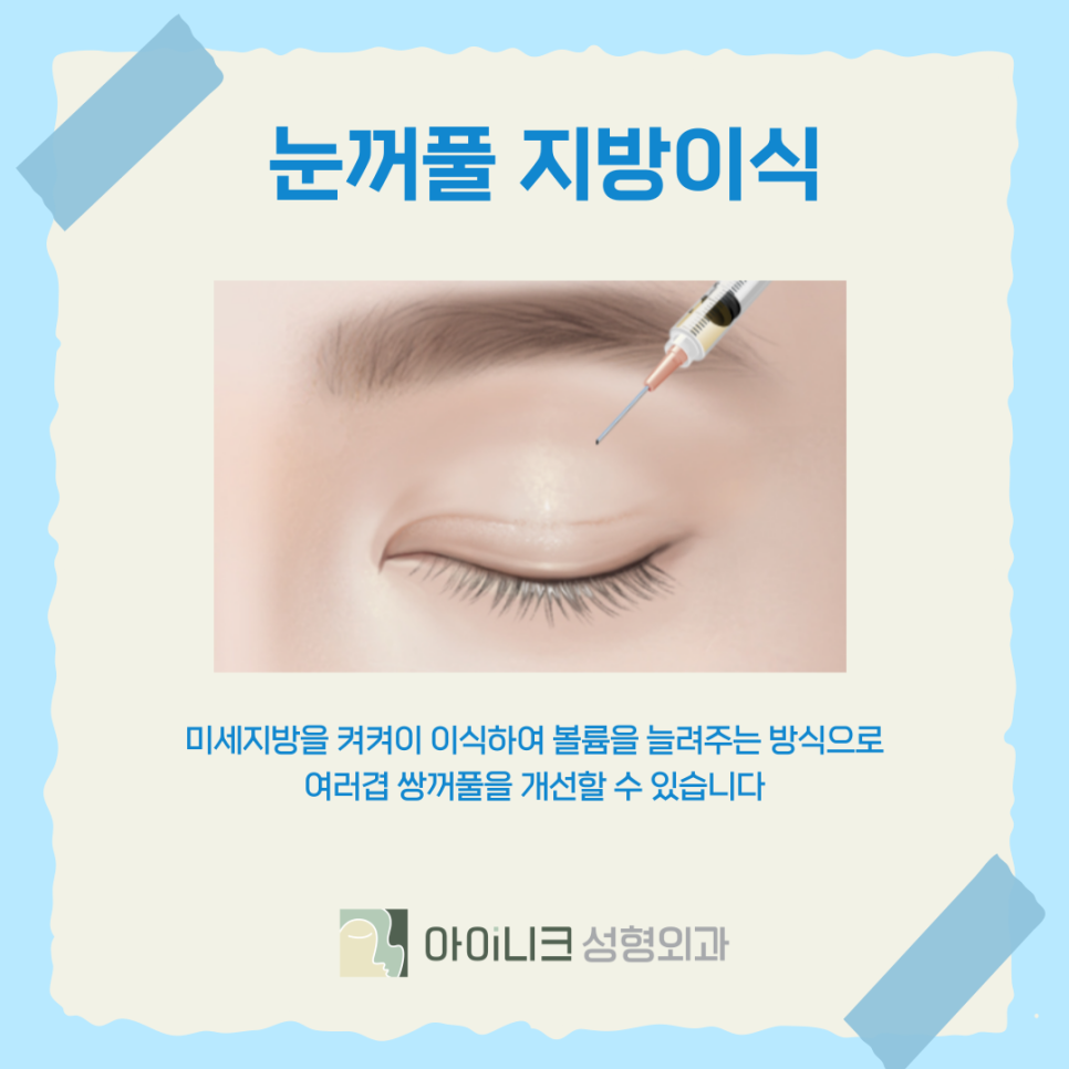 Best Clinic for Double Eyelid Revision Surgery: When Multiple Creases Form image 11