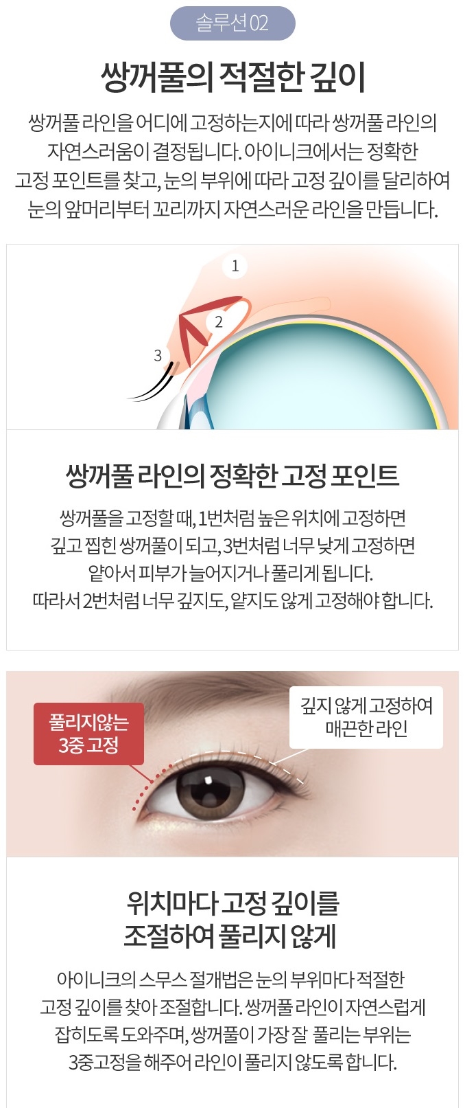 티나는쌍커풀이 걱정이라면 자연스럽게 아름다운 아이니크! 관련 이미지 5