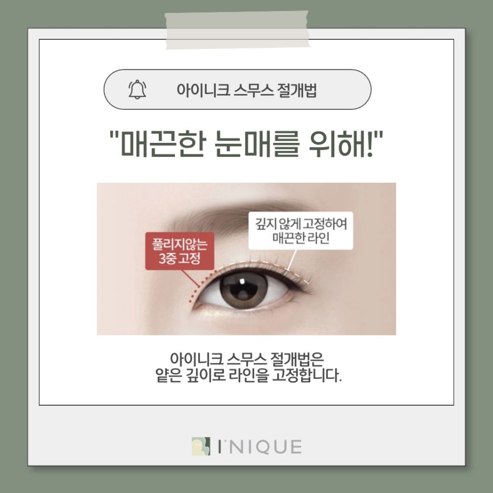 남자쌍수잘하는곳 찾을 때 관련 이미지 2
