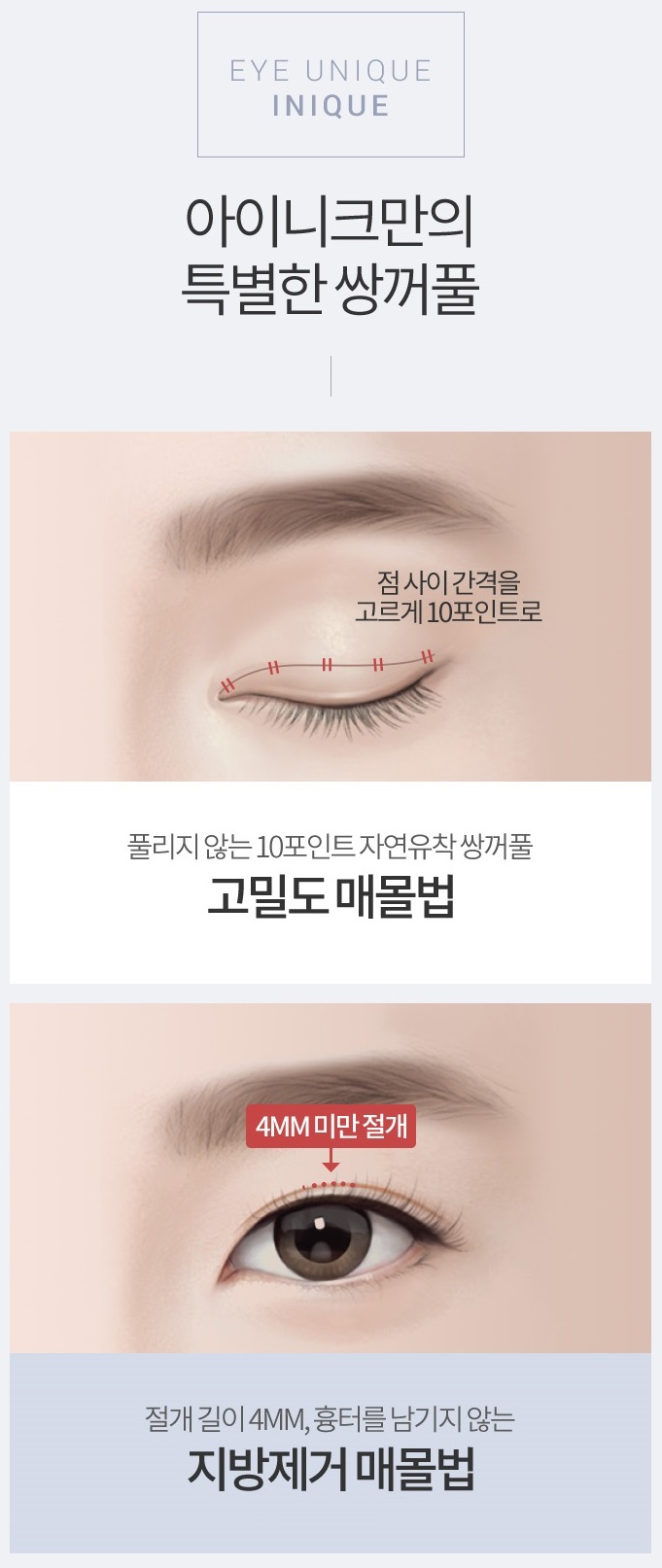 티안나는쌍수 아이니크의 노하우로! 관련 이미지 2