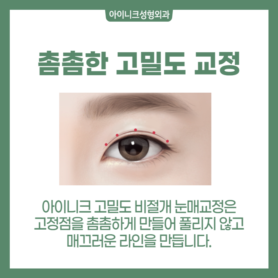 짝눈눈매교정 어떻게 해야 하나요? 관련 이미지 5