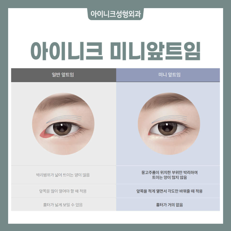 Get Your Blepharoplasty Consultation Done Properly! image 5