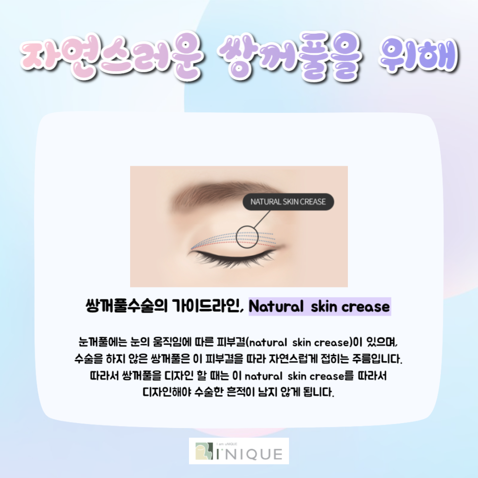 자연스러운쌍꺼풀을 위한 원칙 3가지 관련 이미지 4