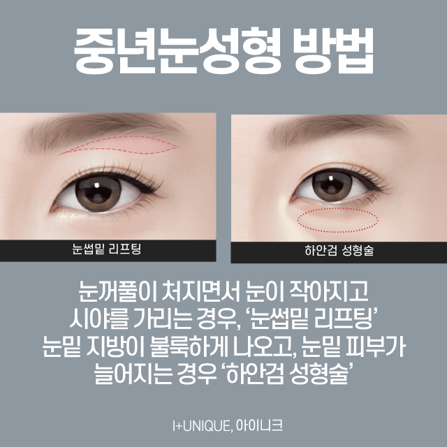 효도성형, 안전하게 해야죠! 관련 이미지 2