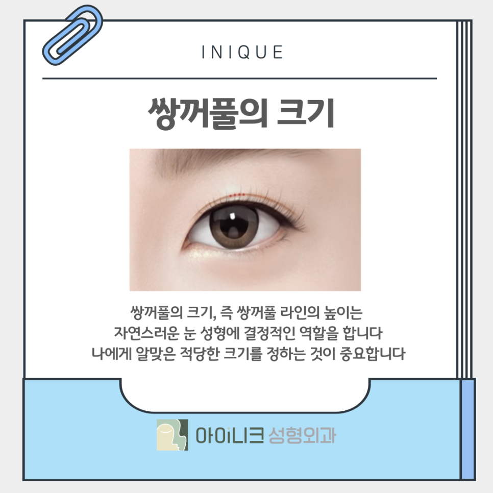 Double Eyelid Surgery: How Can You Create Clear, Beautiful Eyes? image 6