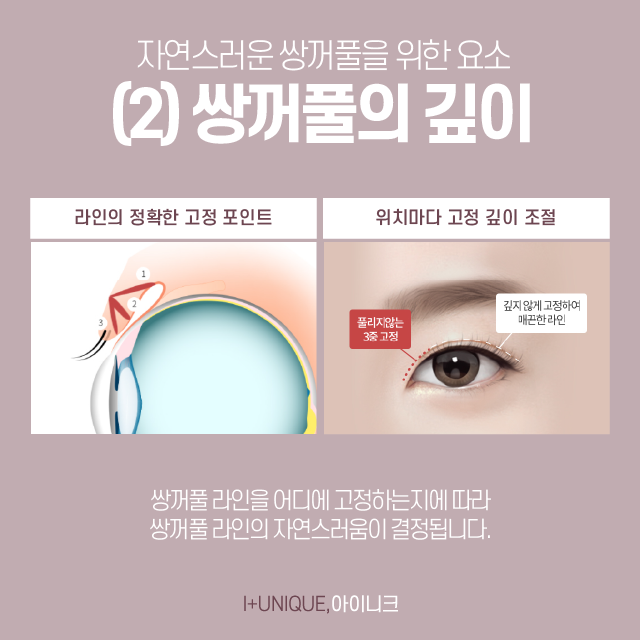 남자눈성형잘하는곳을 찾고 있다면? 관련 이미지 4