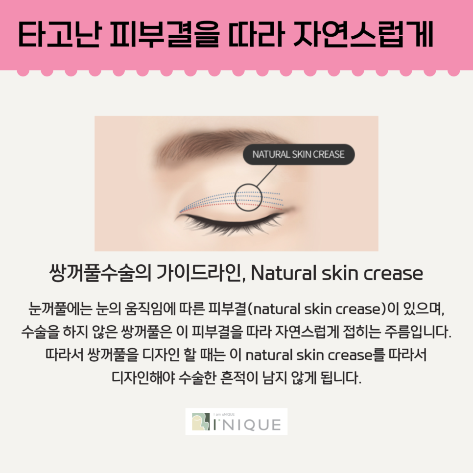 눈성형모델처럼 예쁜 쌍꺼풀 관련 이미지 5
