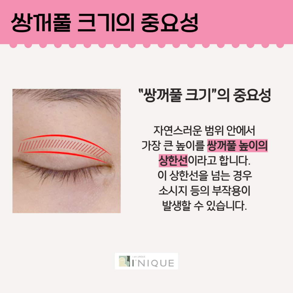 눈성형모델처럼 예쁜 쌍꺼풀 관련 이미지 3