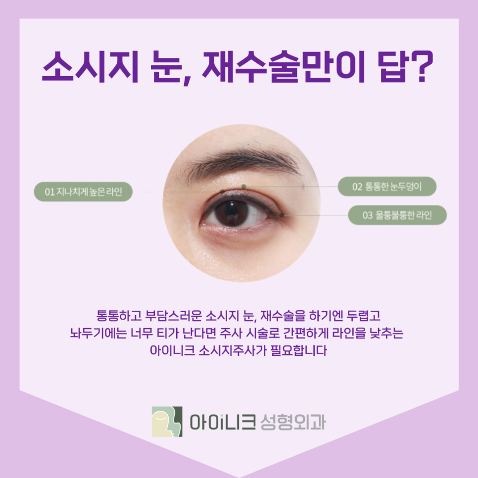 If You're Worried About Revision Double Eyelid Surgery Costs, Try the Sausage Injection! image 7