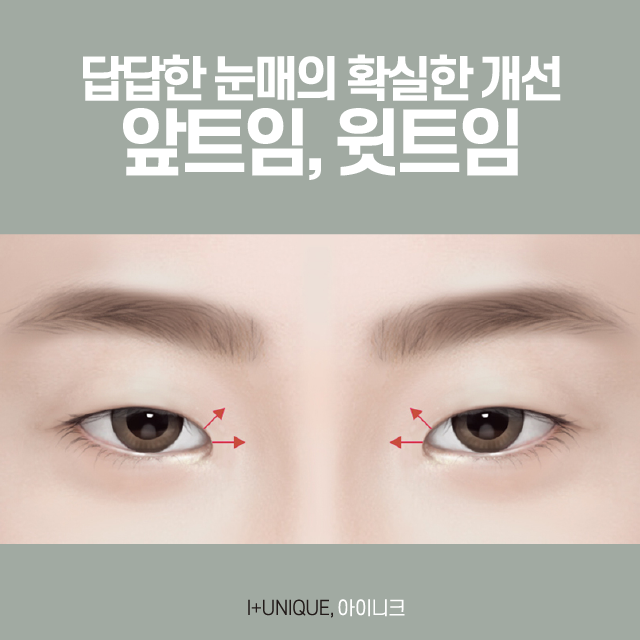 Learn About the Surgical Methods for Gangnam Epicanthoplasty and Eye Shape Correction image 5
