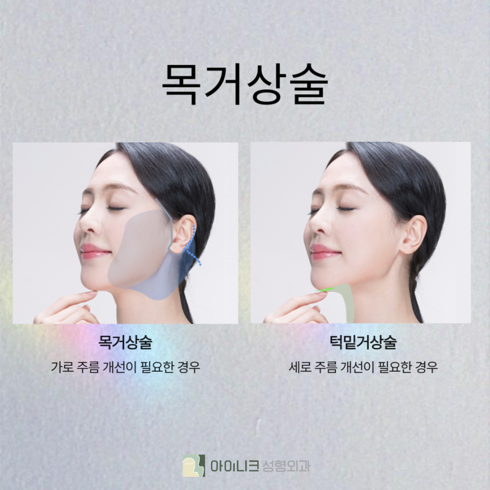 강남안면거상술 잘하는곳 관련 이미지 5