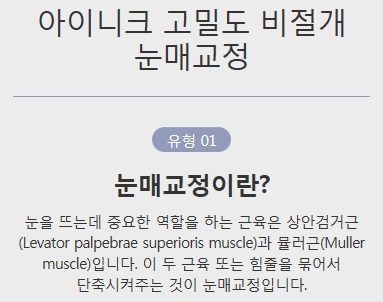 비절개눈매교정술 간단하지만 확실한 관련 이미지 3