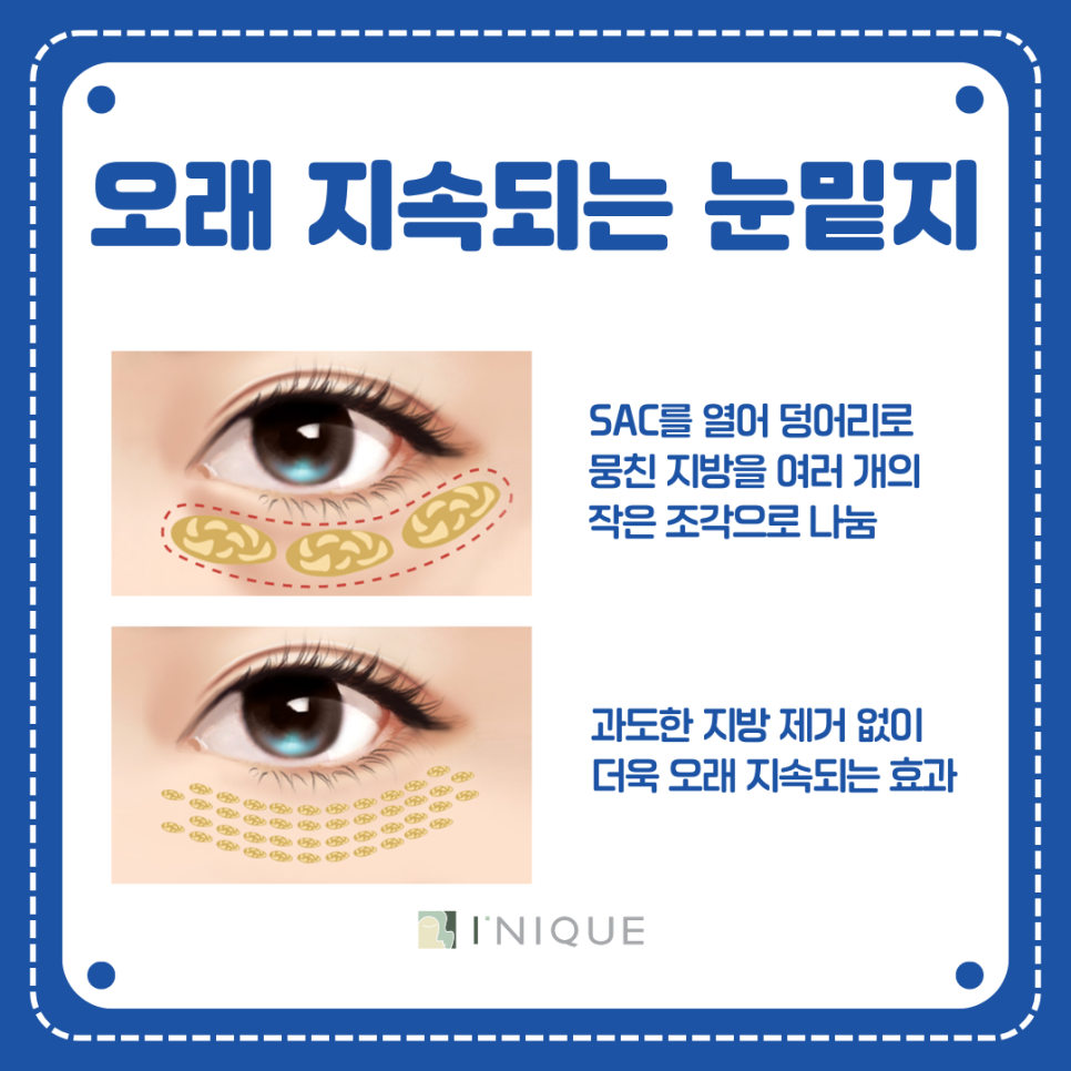 Gangnam Under-Eye Fat Repositioning Clinic: How to Get Rid of Dark Circles image 6