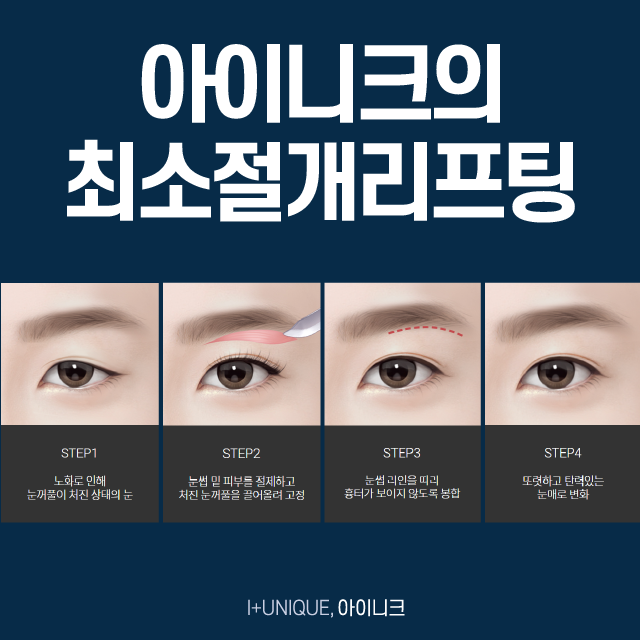 Middle-aged Eye Surgery: Rejuvenate with Minimal-Incision Lifting! image 3