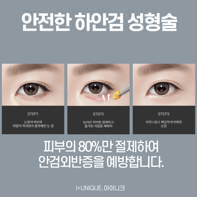 효도성형, 안전하게 해야죠! 관련 이미지 5