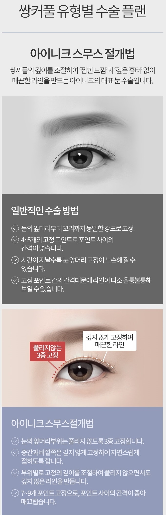 쌍꺼풀수술자국 걱정 없이 예쁘게! 관련 이미지 4