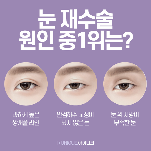 압구정재수술병원을 찾고 있다면 지금 여기!! 관련 이미지 2