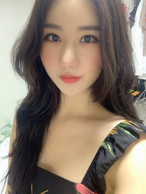 압구정 눈재수술 결정하기 전 꼭 체크할 네가지! 관련 이미지 3