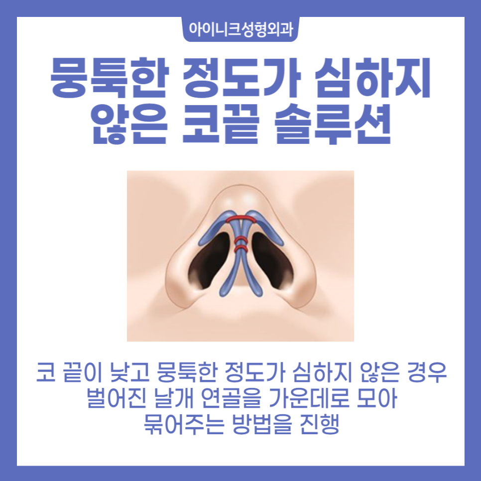 콧대코끝 나만의 디자인을 원한다면? 관련 이미지 3