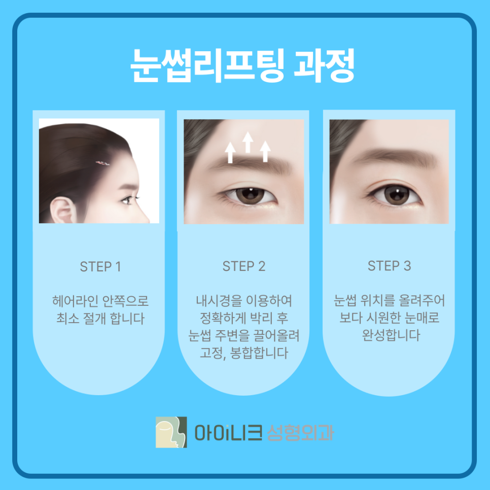 청담 눈썹거상 리프팅 어떻게 진행할까? 관련 이미지 5