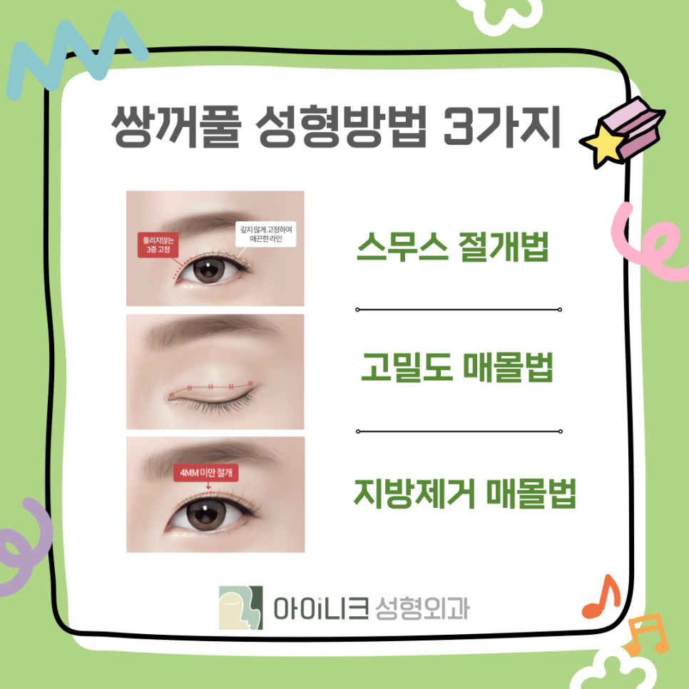 쌍꺼풀수술병원에서 알려드리는 종류와 선택 관련 이미지 8
