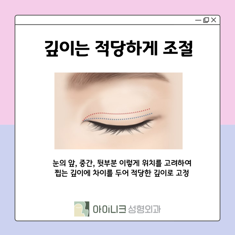 쌍꺼풀재수술잘하는병원 눈꺼풀이 울퉁불퉁하다면? 관련 이미지 9