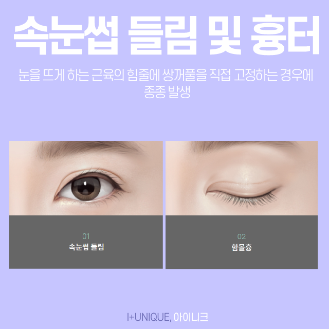 쌍꺼풀재수술병원을 고를 때엔 경험과 노하우가 중요합니다. 관련 이미지 4