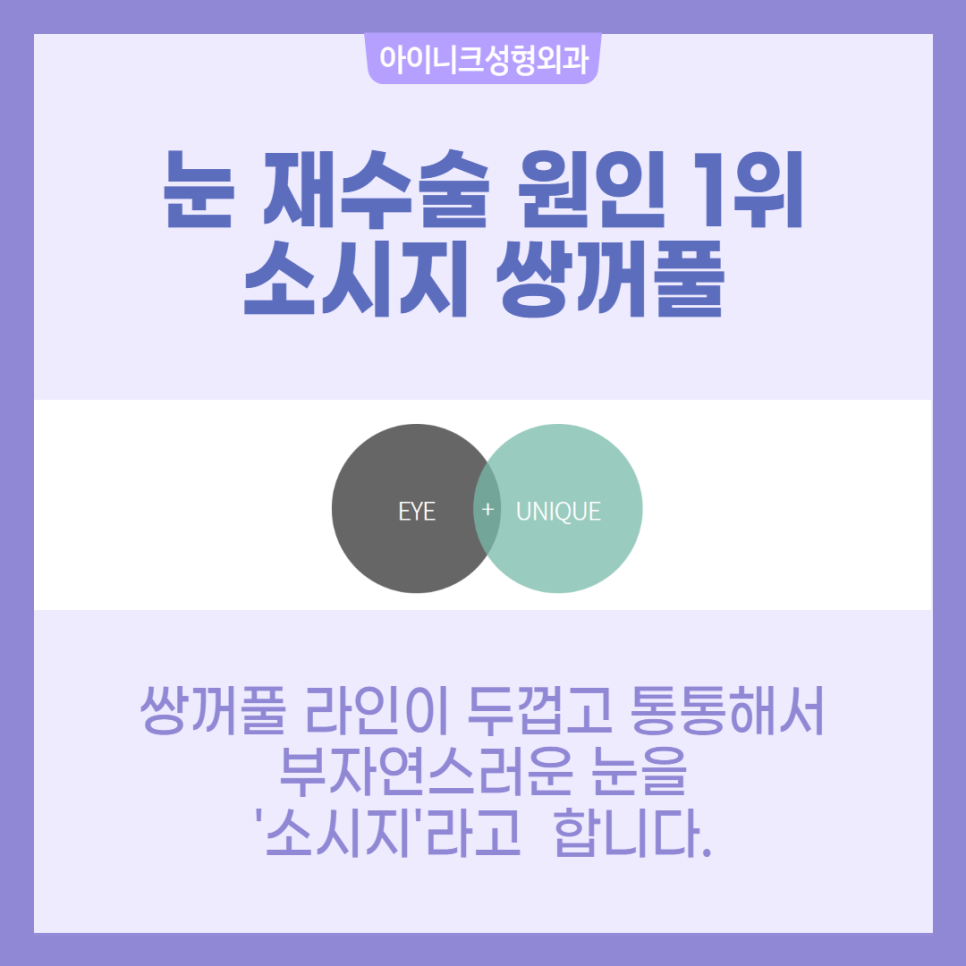 소세지쌍꺼풀 재수술 걱정 마세요! 관련 이미지 2