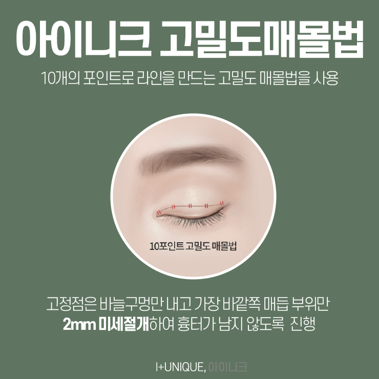강남눈수술 유명한 병원을 찾고 있다면 아이니크성형외과가 답이다. 관련 이미지 4