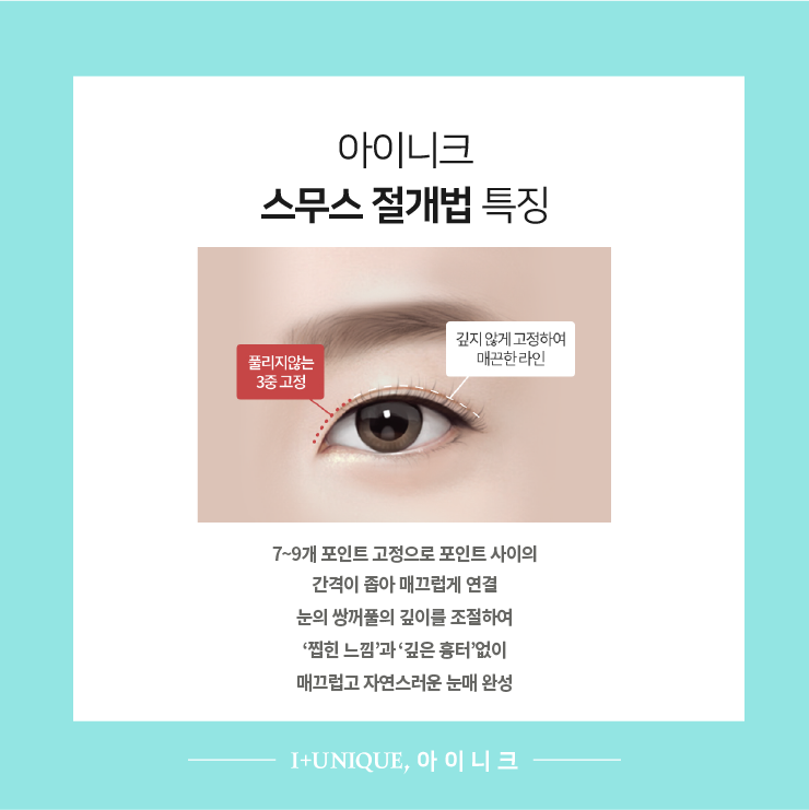 풀리지 않고 자연스럽게 쌍꺼풀절개법 ㅇㅇㄴㅋ 관련 이미지 4
