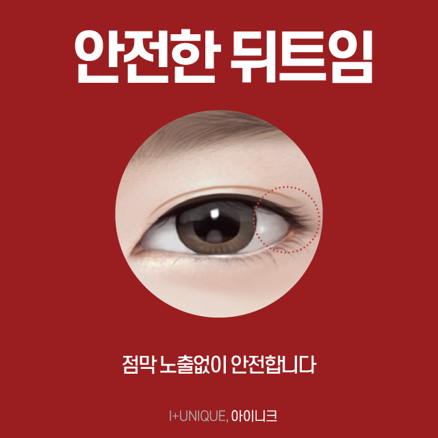 또렷하고 긴 눈매를 원하는 남자분들, 밑트임보다 밑뒤트임을 추천드립니다! 관련 이미지 4