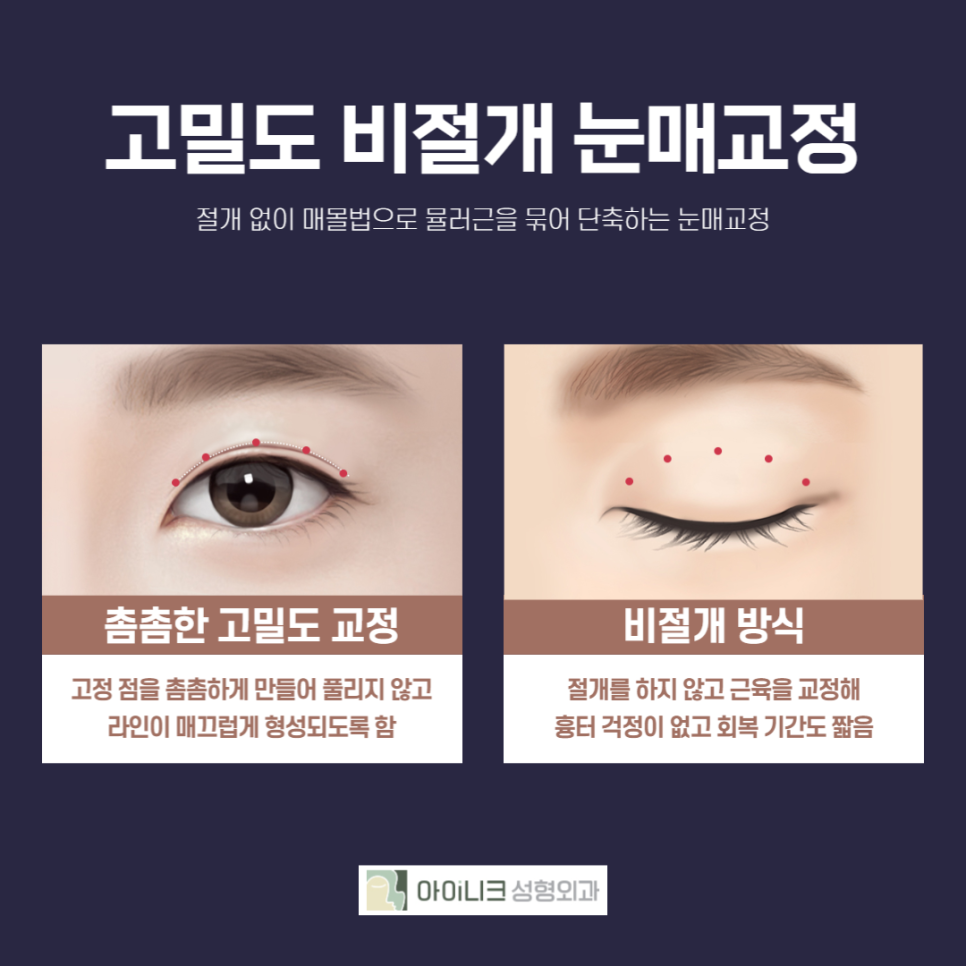 Recommended Eye Surgery! Two Procedures with Less Scarring and Faster Recovery image 2