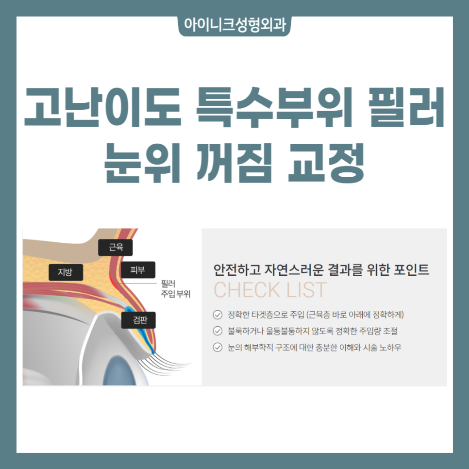 필러잘하는곳에서 간편하고 아름답게! 관련 이미지 3