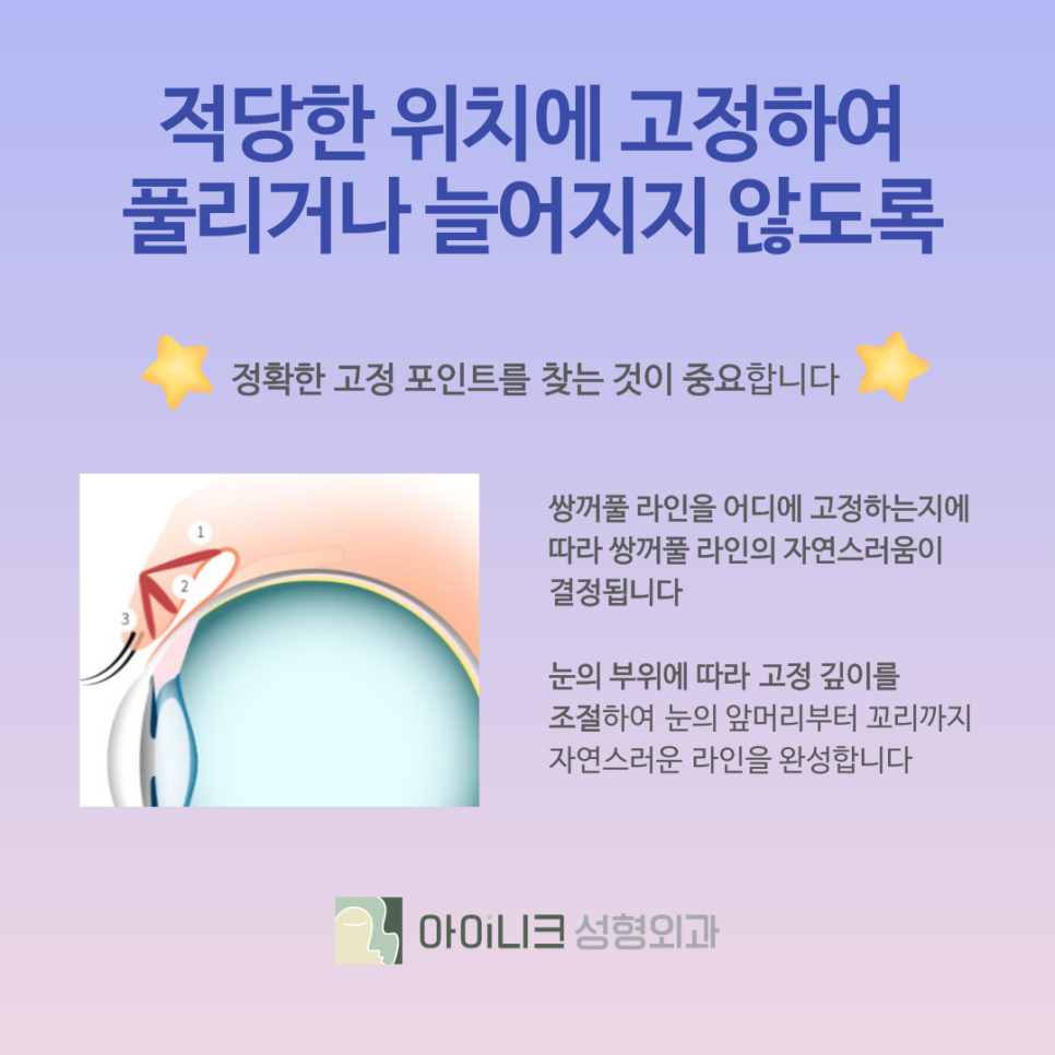 서울 쌍수 잘하는 곳 첫 수술 실패하지 않으려면 관련 이미지 6