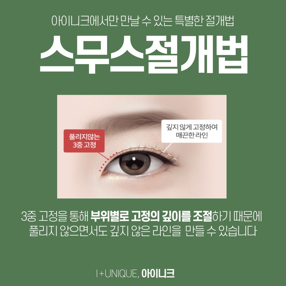 쌍수잘하는병원 아이니크성형외과에서 만드는 또렷한 눈매 관련 이미지 4